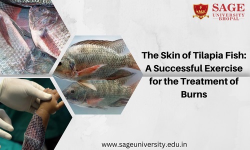 The Skin of Tilapia Fish A Successful Exercise for the Treatment